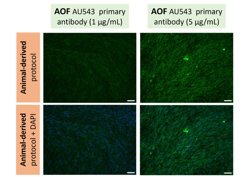 New validated anti-collagen type II antibody